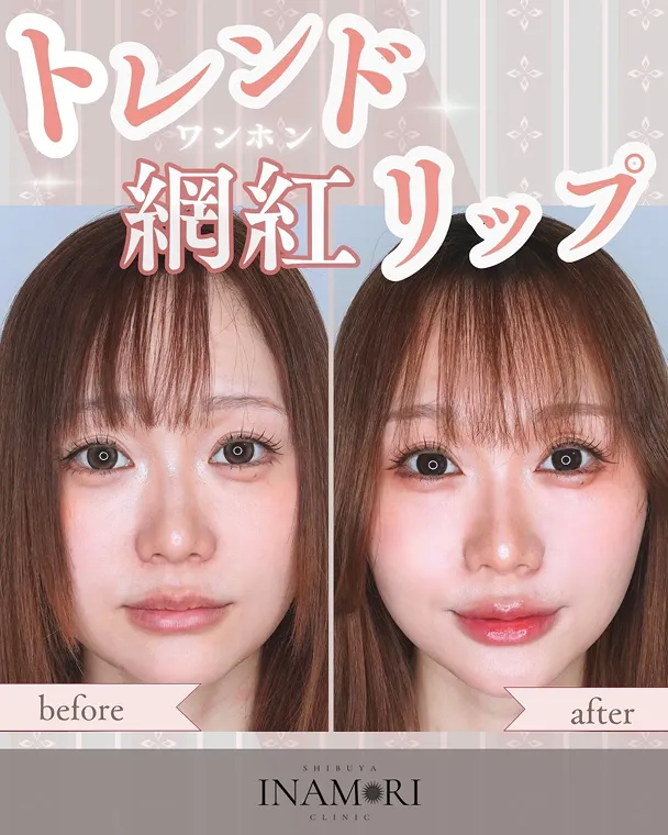 Instagram投稿