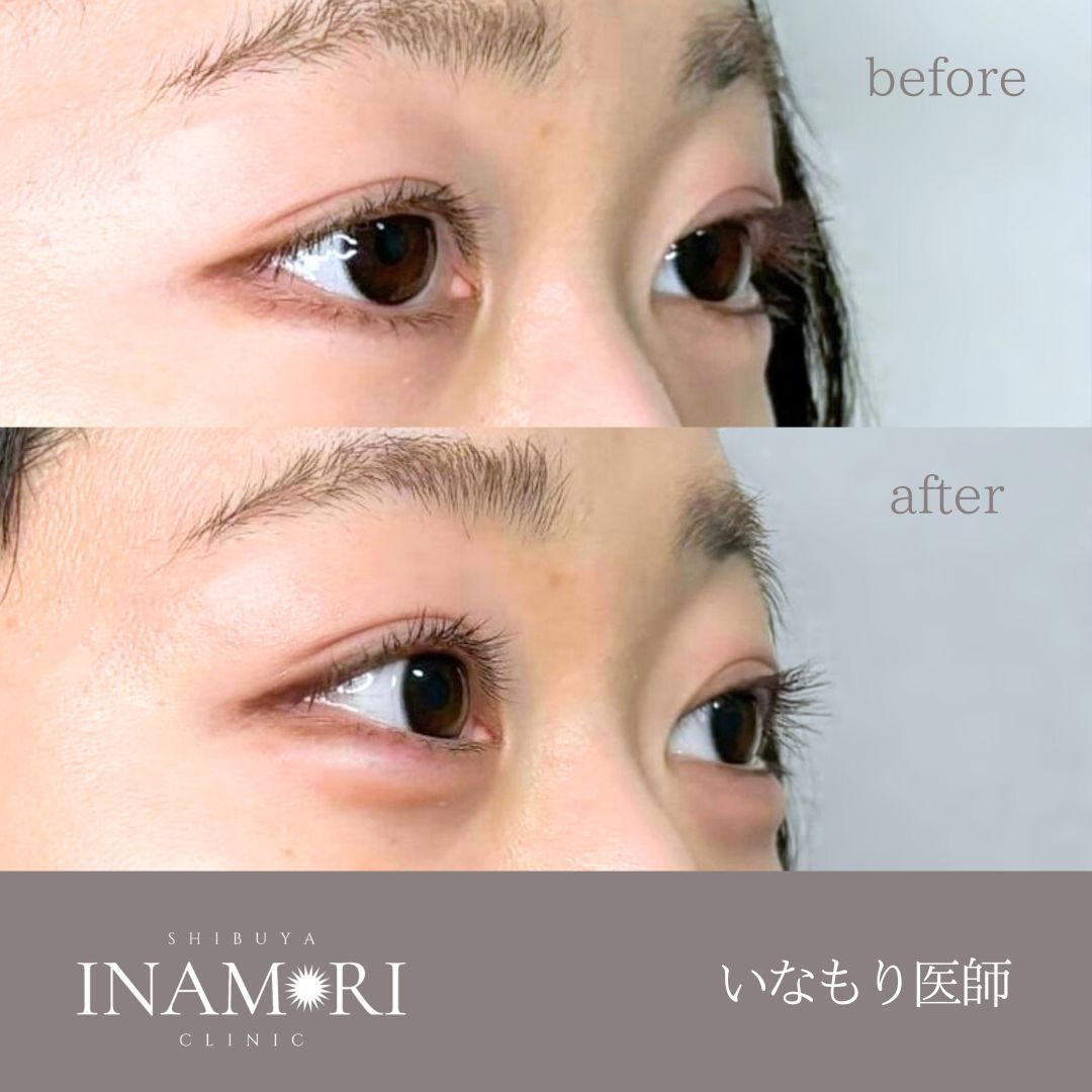 症例Instagram投稿