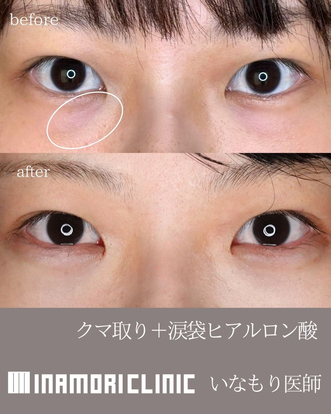 症例Instagram投稿