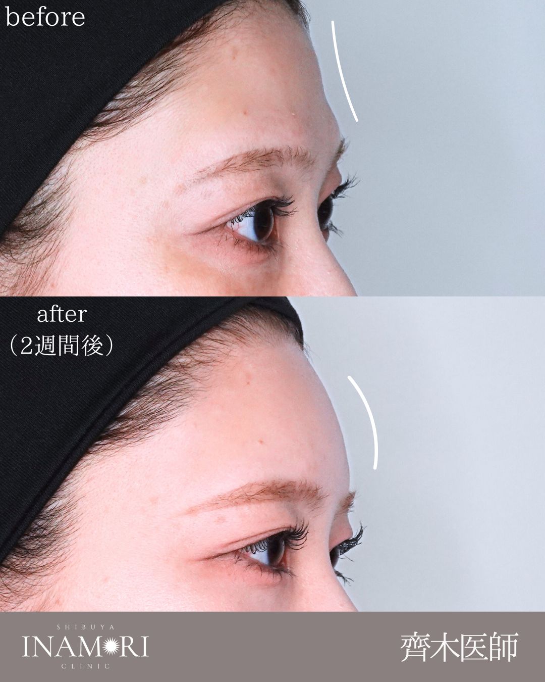 症例Instagram投稿