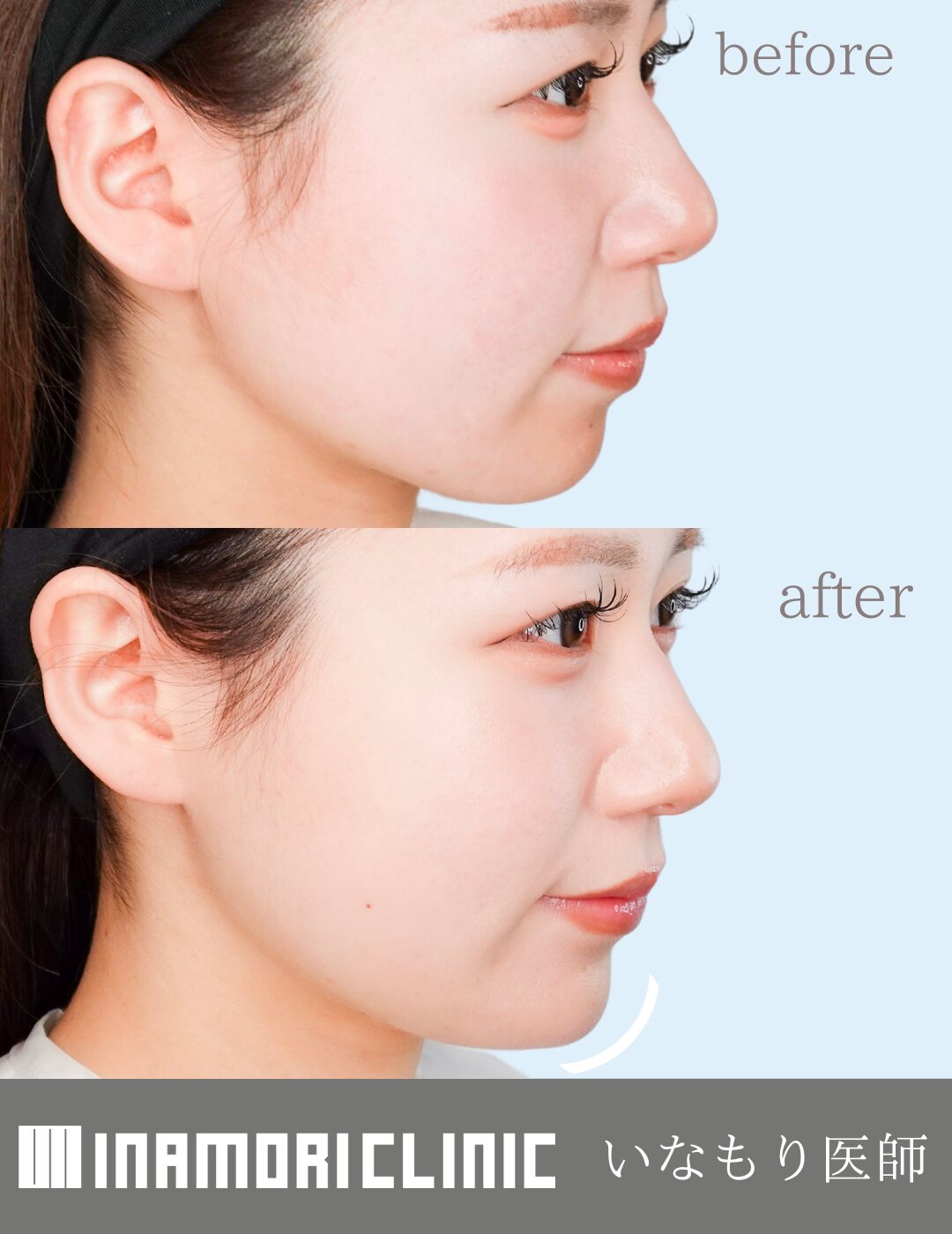 症例Instagram投稿