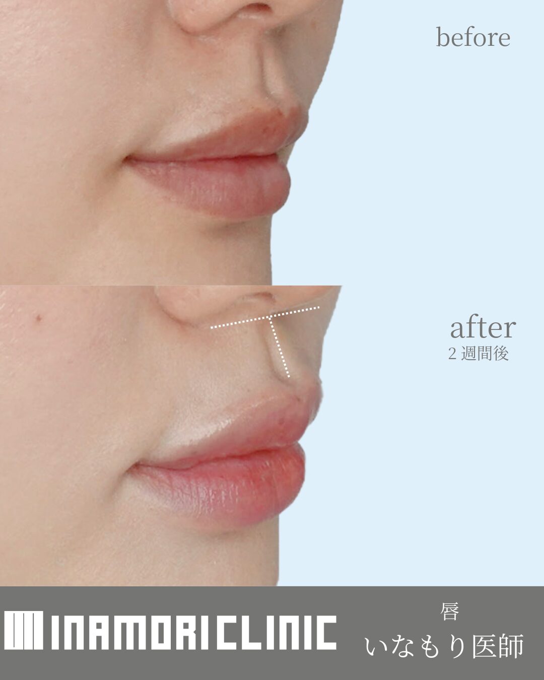 症例Instagram投稿