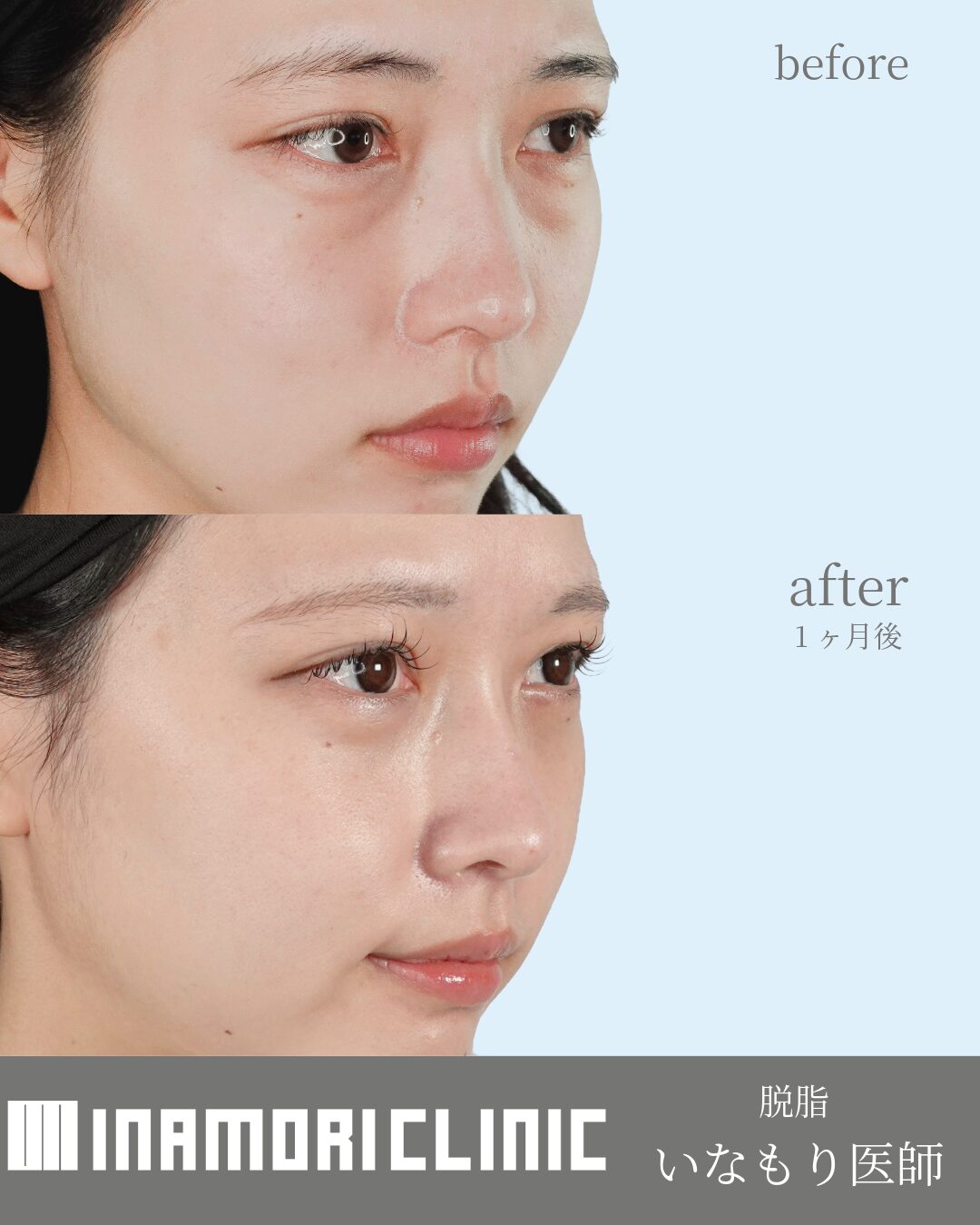 症例Instagram投稿