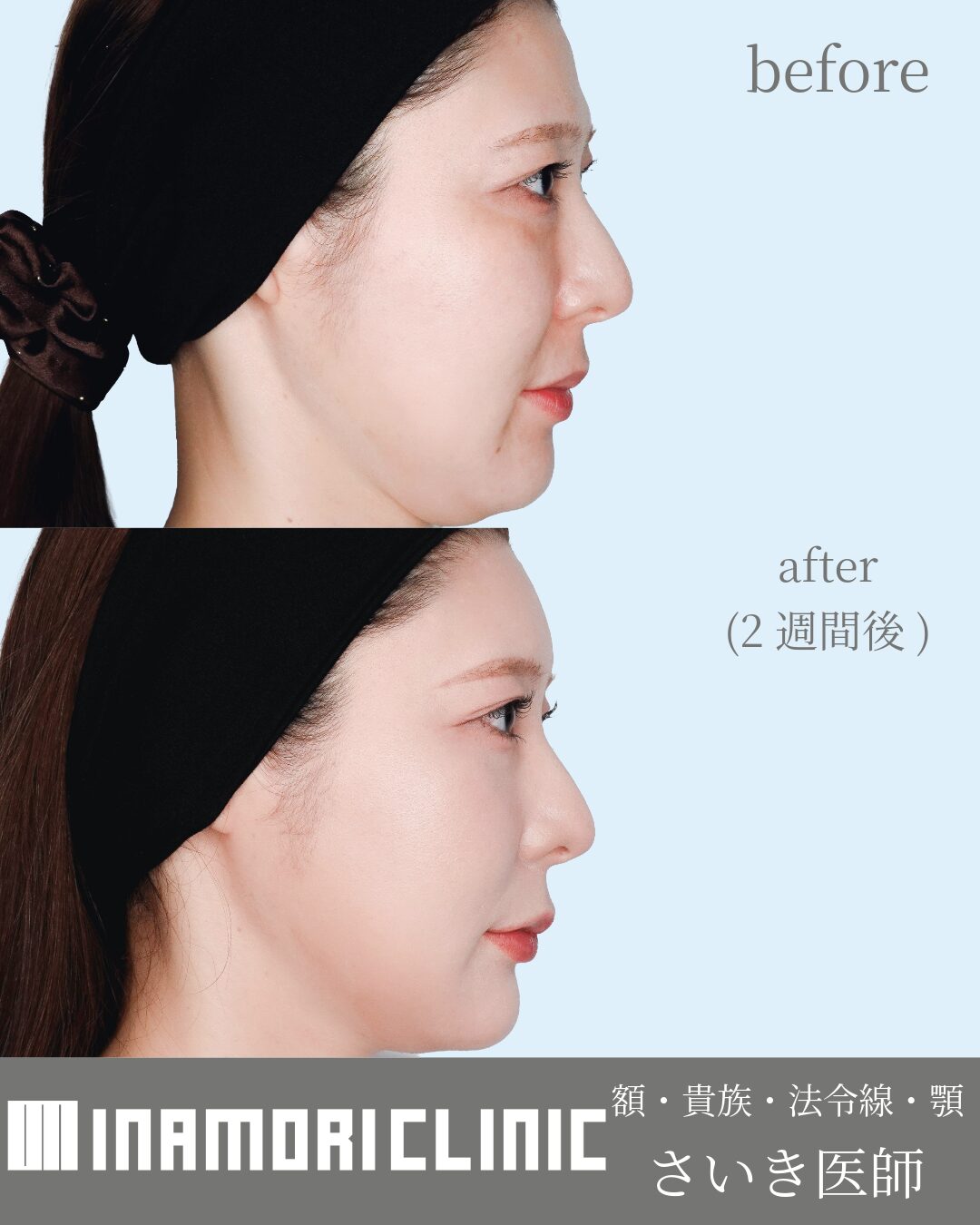 症例Instagram投稿