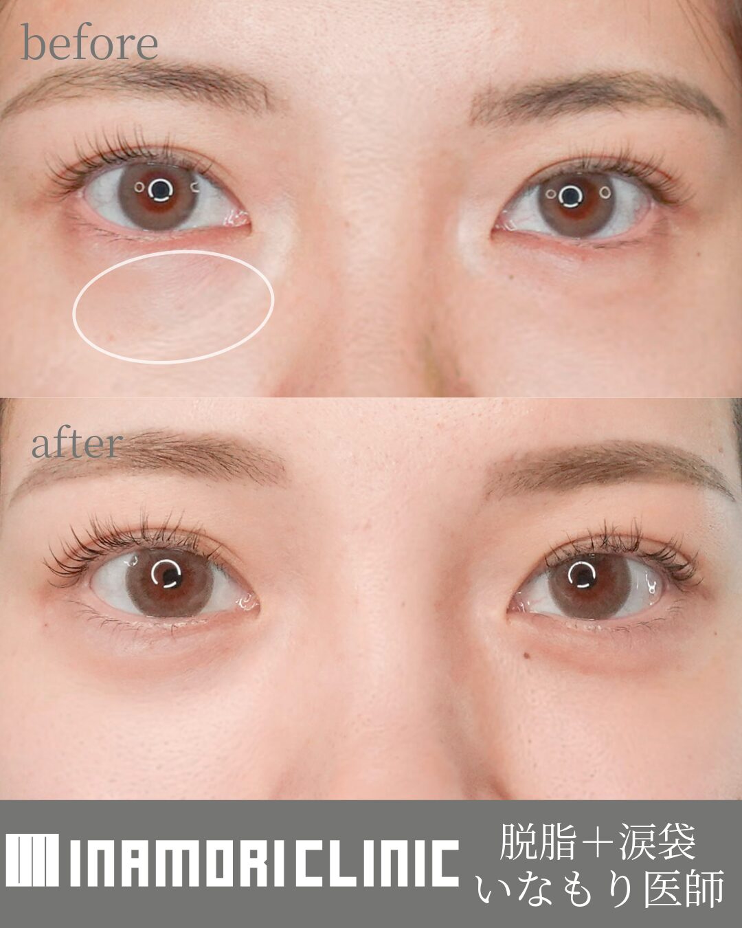 症例Instagram投稿