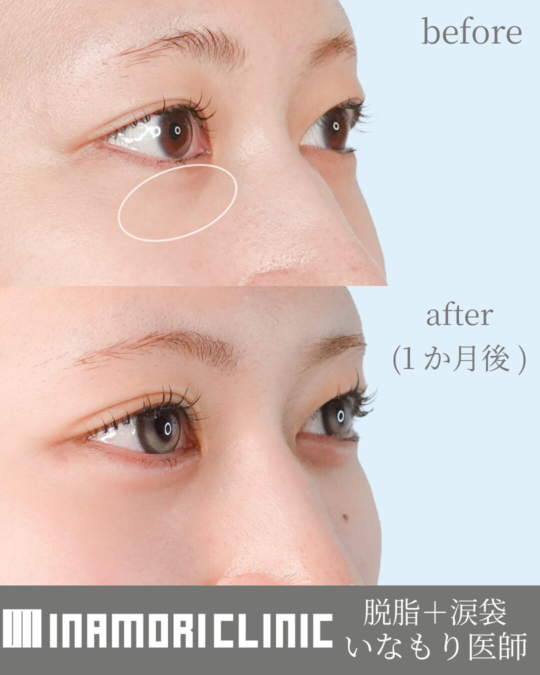 症例Instagram投稿