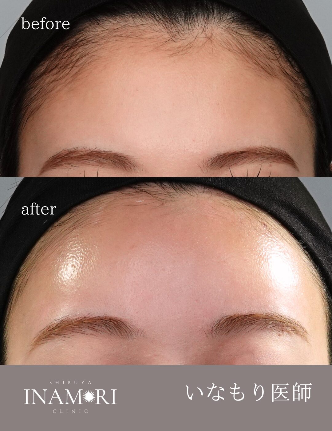 症例Instagram投稿