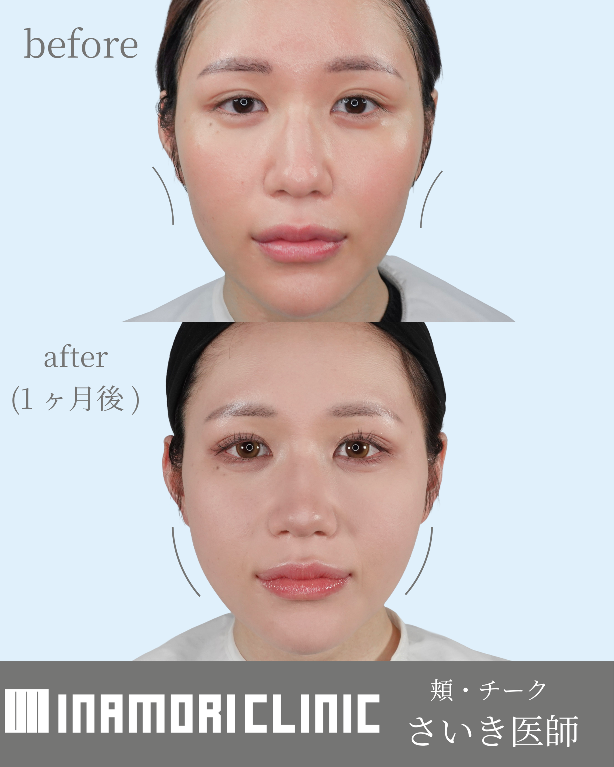 症例Instagram投稿